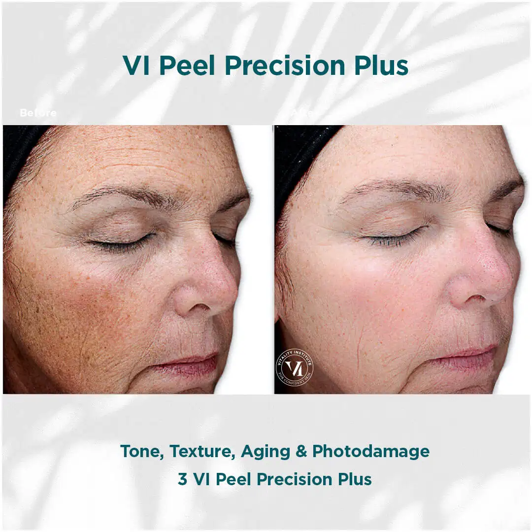 Tone-Texture-Aging
