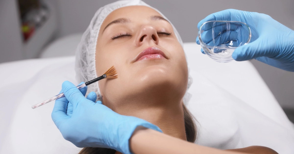 A woman receiving a facial treatment, with a technician applying a Chemical Peels in Lee’s Summit, MO to her cheek using a small brush.